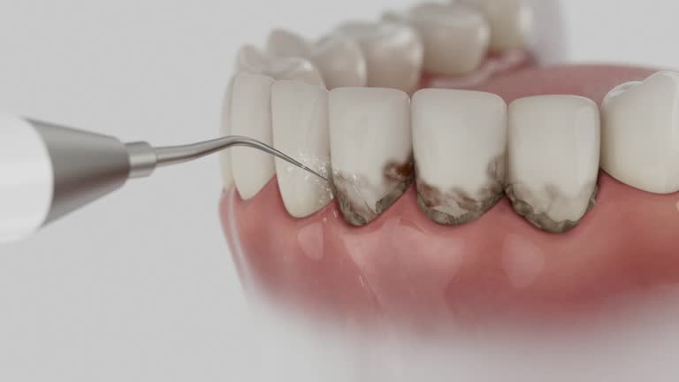 Reliable Dental Implants contractor in Cedar Mill, OR by Smile Center Dentistry